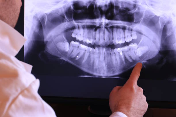 Best Emergency Gum Pain Relief  in Zilwaukee, MI
