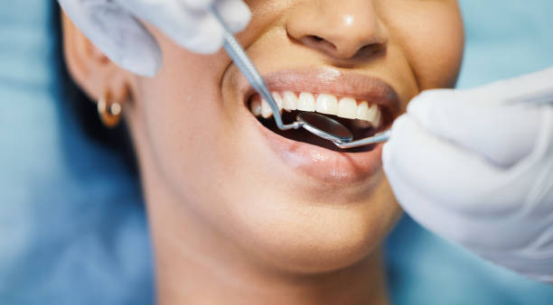 Best Cracked Tooth Emergency Dentist  in Zilwaukee, MI